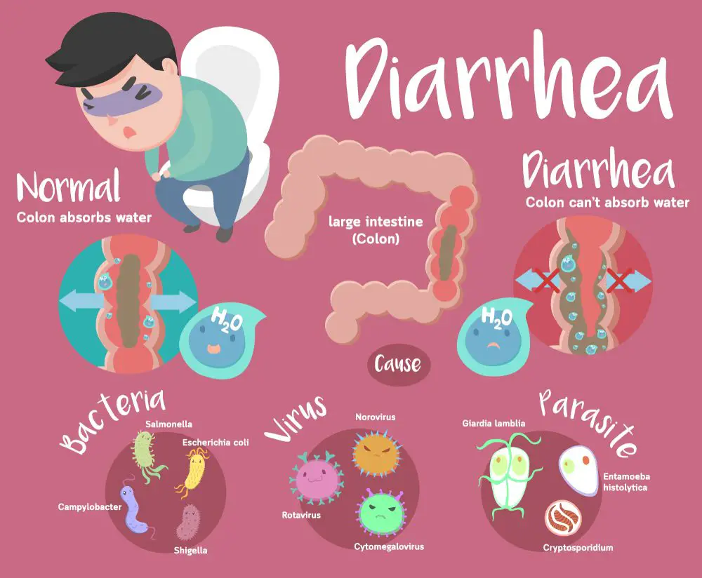 diarrhea-pathophysiology-treatment-and-management