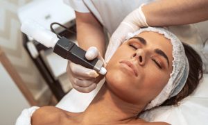 microdermabrasion vs microneedling