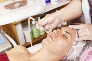 microdermabrasion cost