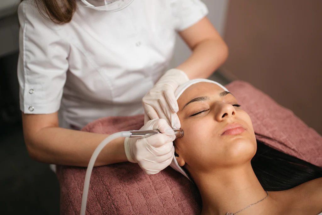 benefits of microdermabrasion