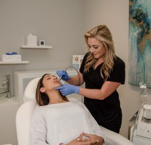 microdermabrasion before and after