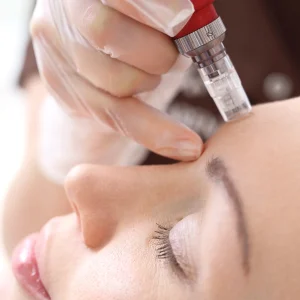 what is microneedling