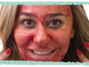 Side Effects Of Microneedling