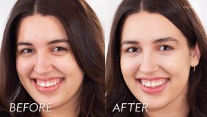 hydrafacial benefits